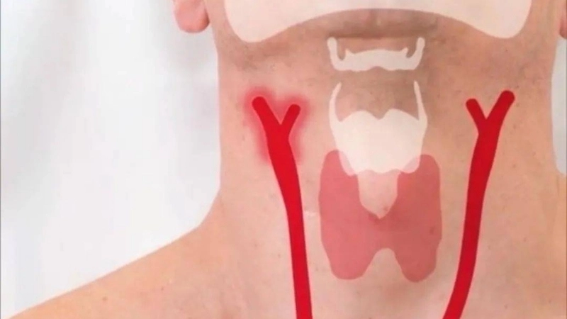 Triệu chứng khi bị bóp cổ