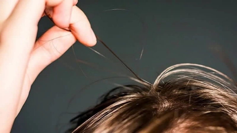 Bị giật tóc có sao không?