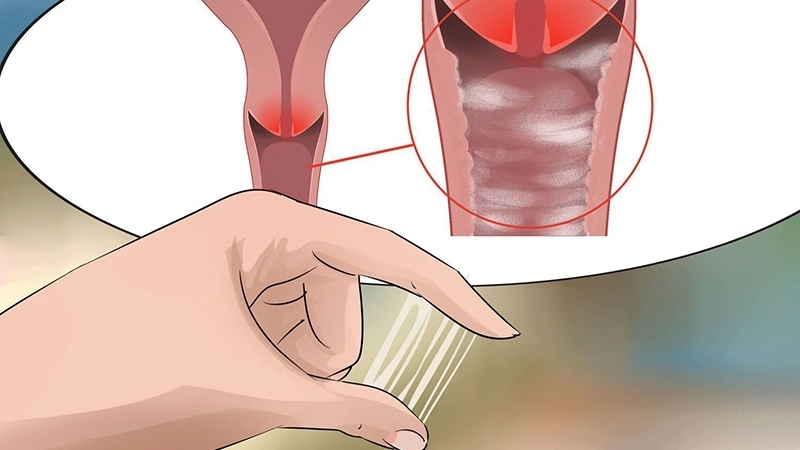 Mẹo và biện pháp chữa trị khi bị rỉ ối