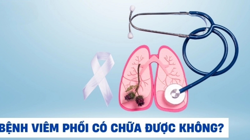 Mẹo và biện pháp chữa trị khi bị viêm phổi