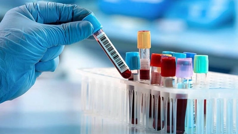 Làm sao để kiểm soát chỉ số GGT trong mức an toàn?