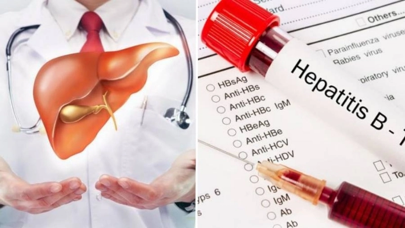 Cần làm gì khi có kết quả HBsAg dương tính?