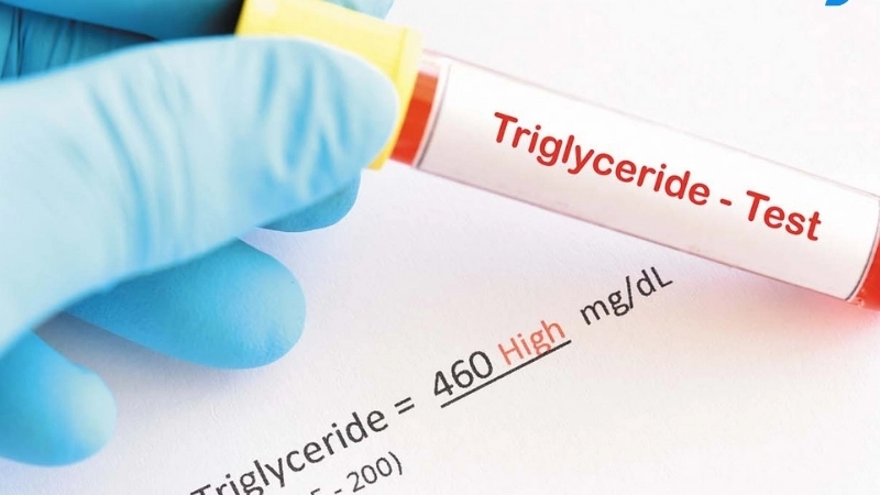 Bao nhiêu là chỉ số Triglyceride lý tưởng?
