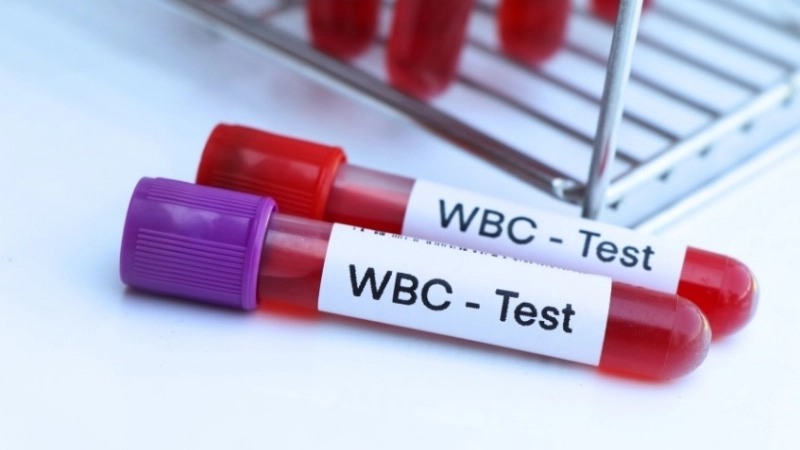 Chỉ số WBC giảm thấp cảnh báo nguy cơ suy giảm miễn dịch.