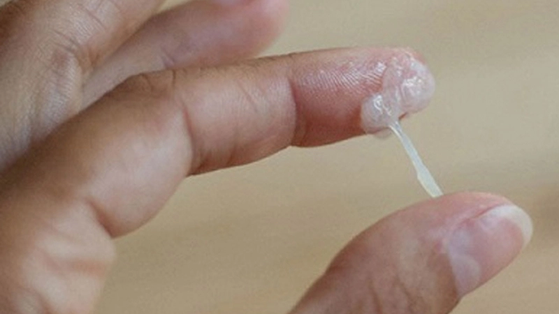 Mẹo và biện pháp chữa trị khi bị khí hư ra nhiều