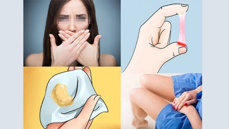 Triệu chứng khi bị khí hư ra nhiều bất thường