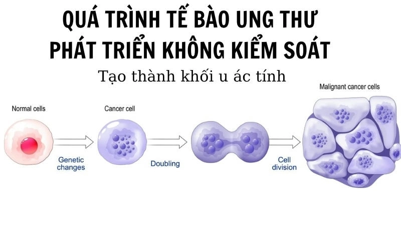 Quá trình tế bào ung thư phát triển không kiểm soát, tạo thành khối u ác tính