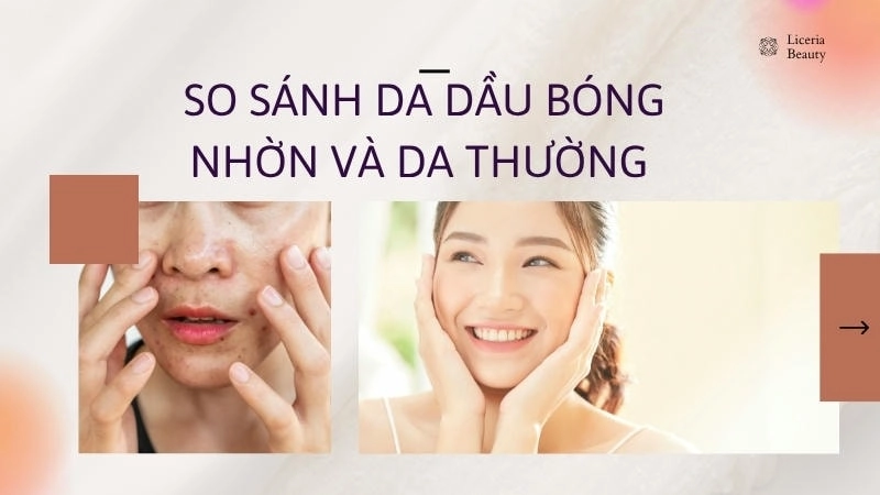 So sánh da dầu bóng nhờn và da thường mịn màng