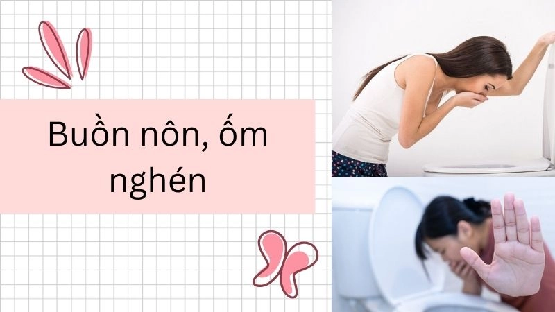 Buồn nôn, ốm nghén – “Cơn ác mộng” buổi sáng