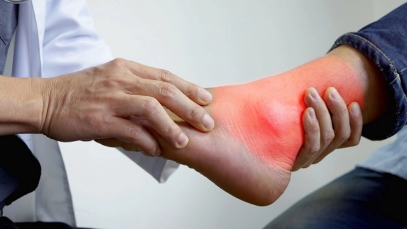 Vì sao phát hiện sớm gout rất quan trọng?