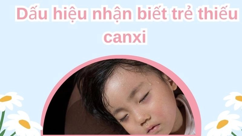 Dấu hiệu nhận biết trẻ thiếu canxi sớm nhất
