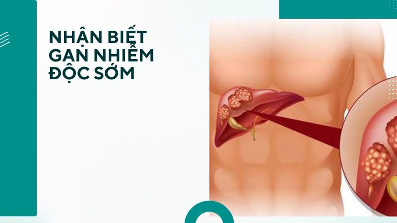 Cách nhận biết gan bị nhiễm độc để điều trị kịp thời