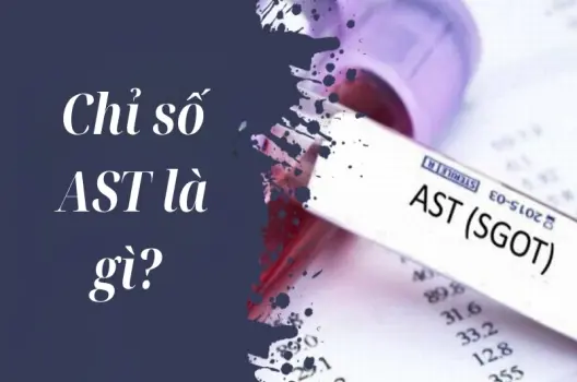 AST là chỉ số gì và cảnh báo gì về sức khỏe gan của bạn