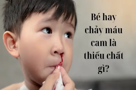 Bé hay chảy máu cam là thiếu chất gì cha mẹ cần biết