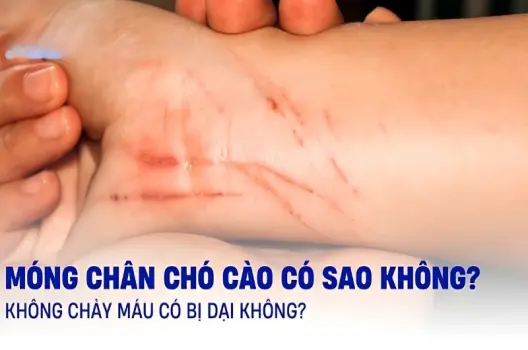 Bị chó cào có sao không và cách xử lý an toàn