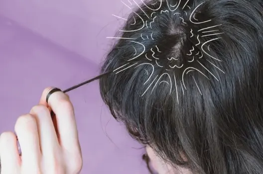 Bị giật tóc có sao không và dấu hiệu cần đi khám sớm