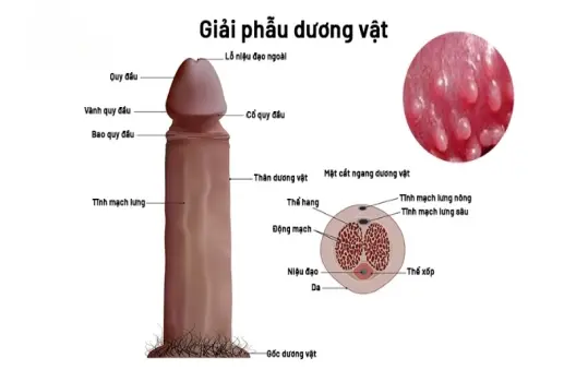 Bị hạt ngọc có sao không và cách xử lý hiệu quả