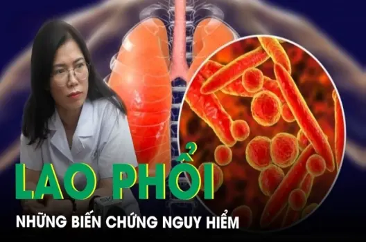 Bị lao phổi có sao không và có chữa khỏi không