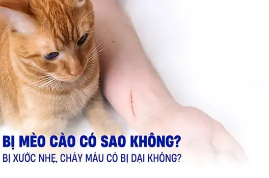 Bị mèo cào có sao không? Biện pháp sơ cứu nhanh