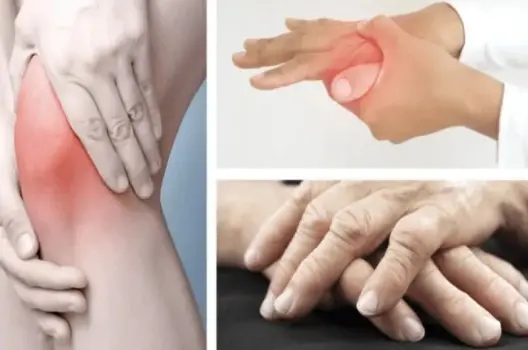 Bị phong thấp có sao không và cách điều trị hiệu quả