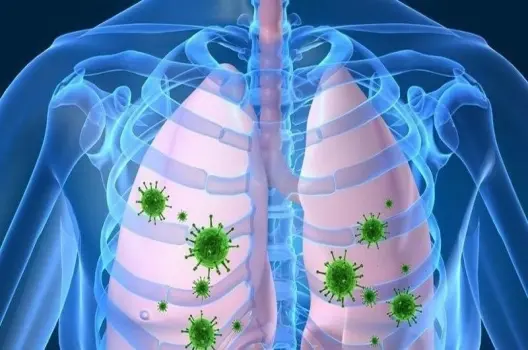 Bị viêm phổi có sao không? Dấu hiệu và cách xử lý