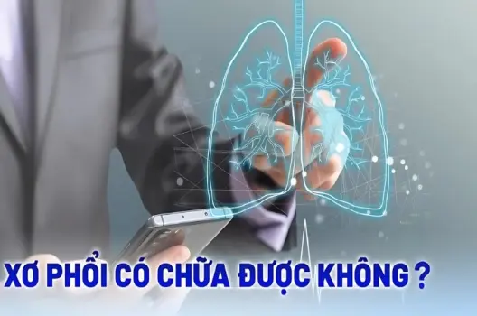 Bị xơ phổi có sao không và cách nhận biết sớm bệnh lý