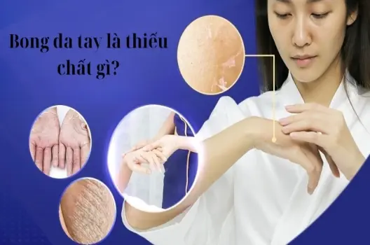 Bong da tay là thiếu chất gì và cách khắc phục hiệu quả