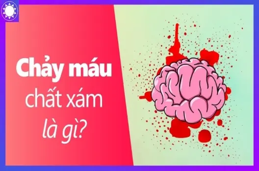 Chảy máu chất xám là gì? Mối lo trong thời hội nhập