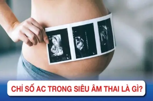 Chỉ số AC trong siêu âm thai là gì và có ý nghĩa ra sao