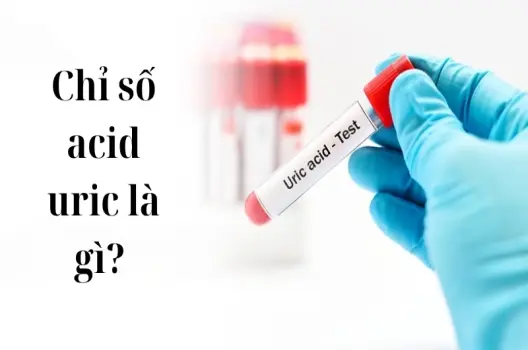 Tìm hiểu chỉ số acid uric là gì và các mức độ nguy hiểm