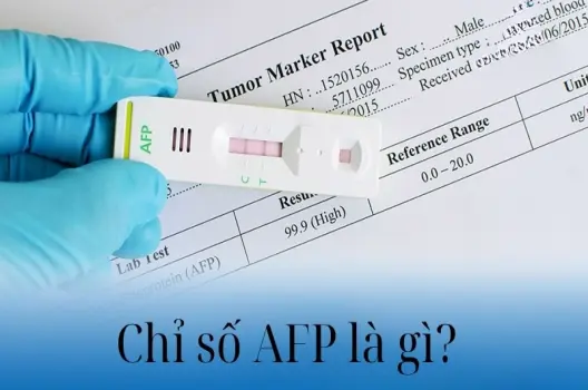 Tìm hiểu chỉ số AFP là gì và vai trò trong chẩn đoán y khoa