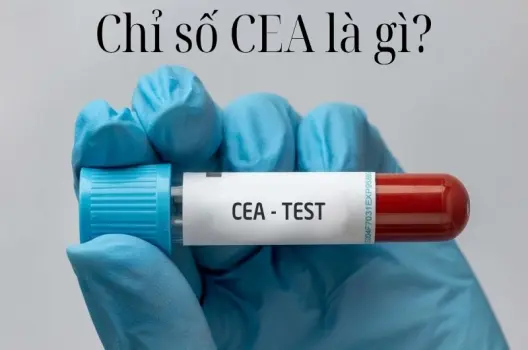 Xét nghiệm chỉ số CEA là gì và khi nào nên thực hiện