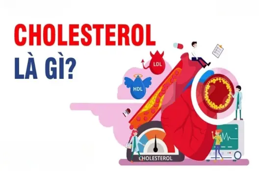 Chỉ số cholesterol là gì và ảnh hưởng đến sức khỏe ra sao