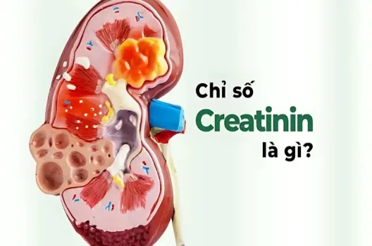 Chỉ số creatinin là gì và những điều ai cũng cần biết