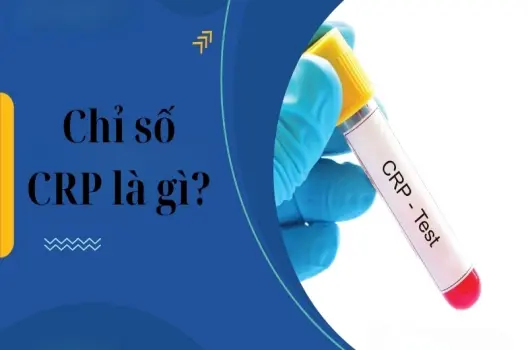 Chỉ số CRP là gì? khi nào cần làm xét nghiệm CRP