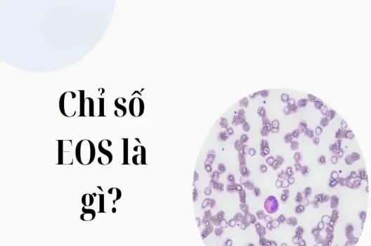 Chỉ số eos là gì? Những điều người bệnh cần hiểu rõ ngay