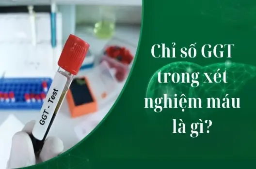 Chỉ số GGT trong xét nghiệm máu là gì và có ý nghĩa gì?