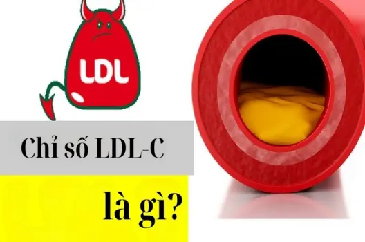 Chỉ số LDL-C là gì? Ảnh hưởng tới sức khỏe ra sao