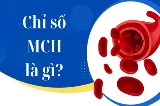 Chỉ số MCH là gì và ý nghĩa trong xét nghiệm máu