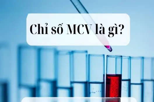 Giải mã chỉ số MCV là gì trong kết quả xét nghiệm máu