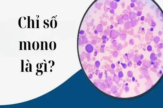 Chỉ số mono là gì và mức bao nhiêu là bình thường