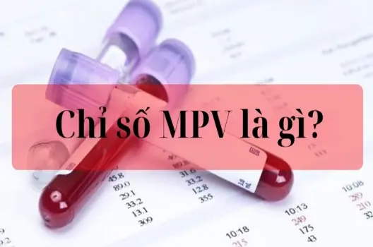 Chỉ số MPV là gì và ý nghĩa với sức khỏe của bạn