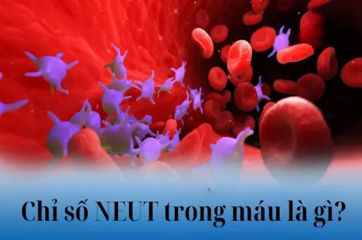 Chỉ số neut trong máu là gì và có liên quan bệnh lý nào?