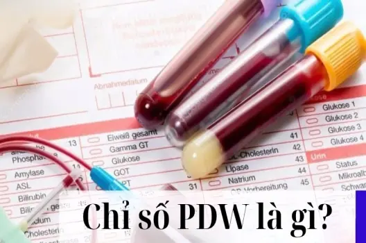 Chỉ số PDW là gì và ý nghĩa trong kết quả xét nghiệm