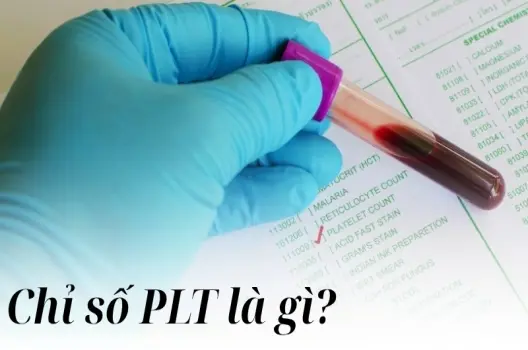 Chỉ số PLT là gì và ảnh hưởng đến sức khỏe ra sao