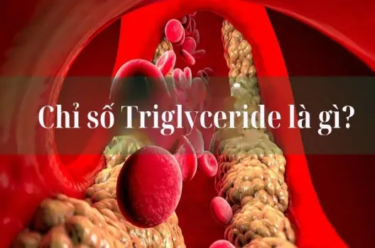 Chỉ số triglyceride là gì và cách kiểm soát hiệu quả