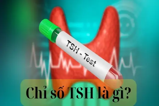 Chỉ số TSH là gì và ý nghĩa trong chẩn đoán bệnh