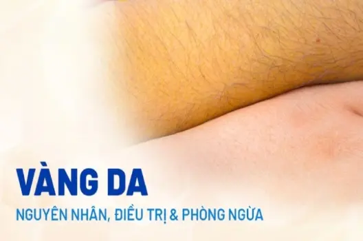 Da vàng có bị sao không dấu hiệu cảnh báo sức khỏe