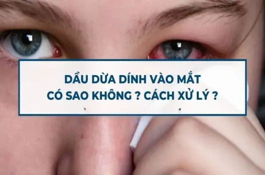 Dầu dừa vào mắt có bị sao không? Giải đáp chi tiết