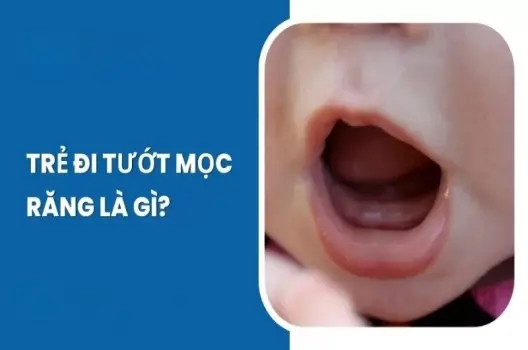 Em bé bị tướt có sao không và cách xử lý hiệu quả